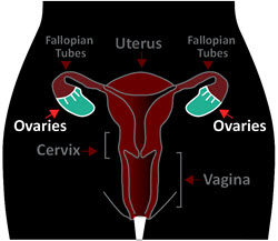 Ovarian Cancer Symptoms, Prevention & Treatment | Centura Health